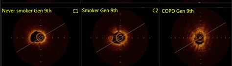 02气道横截面OCT影像3.jpg